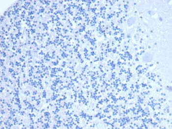 Negative control: IHC staining of FFPE human brain tissue with Neprilysin antibody (clone MME/6461) at 2ug/ml in PBS for 30min RT. HIER: boil tissue sections in pH 9 10mM Tris with 1mM EDTA for 20 min and allow to cool before testing.