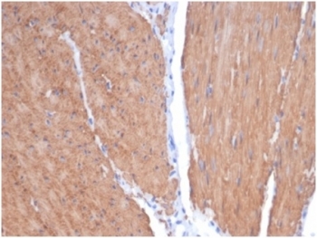 Recombinant SMMHC Antibody Smooth Muscle IHC. Immunohistochemical staining of FFPE human smooth muscle tissue demonstrates robust expression of Smooth Muscle Myosin Heavy Chain using recombinant SMMHC antibody clone MYH11/7087R. SMMHC, encoded by the MYH11 gene, is a principal component of the contractile apparatus and one of the most specific markers of mature smooth muscle differentiation. Strong diffuse cytoplasmic staining is observed throughout bundles of spindle-shaped smooth muscle cells, consistent with the abundant expression of MYH11 in contractile tissues. Heat induced epitope retrieval was performed by boiling tissue sections in pH 9 10 mM Tris with 1 mM EDTA for 20 minutes followed by cooling prior to staining. These results support the utility of SMMHC Antibody for studies of vascular biology, smooth muscle pathology, and tissue differentiation.