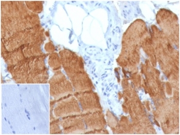 IHC staining of FFPE human skeletal muscle tissue with Actin alpha 1 (clone ACTA1/360). Negative control inset: PBS instead of primary antibody to control for secondary binding. HIER: boil tissue sections in pH 9 10mM Tris with 1mM EDTA for 20 min and allow to cool before testing.