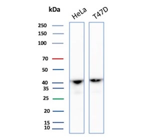 Western blot testing of human HeLa and T-47D cell lysate with Actin alpha 1 antibody. Predicted molecular weight ~42 kDa.