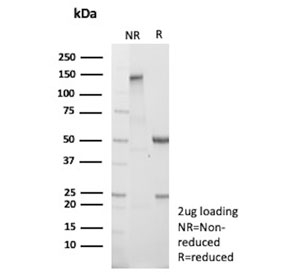 SDS-PAGE analysis of purified, BSA-free Actin alpha 1 antibody (clone ACTA1/360) as confirmation of integrity and purity.
