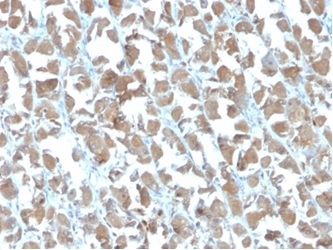 MICA Antibody Stomach Tissue IHC. Immunohistochemistry staining of FFPE human stomach with MICA antibody (clone MICA/4442). HIER: boil tissue sections in pH 9 10mM Tris with 1mM EDTA for 20 min and allow to cool before testing.