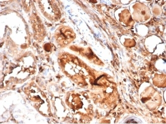 MICA Antibody Kidney Tissue IHC. Immunohistochemistry staining of FFPE human kidney tissue with MICA antibody (clone MICA/4442). HIER: boil tissue sections in pH 9 10mM Tris with 1mM EDTA for 20 min and allow to cool before testing.