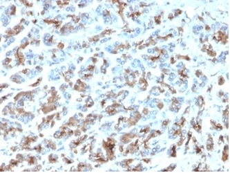MICA Antibody Human Stomach IHC. Immunohistochemistry staining of FFPE human stomach with MICA antibody (clone MICA/4443). HIER: boil tissue sections in pH 9 10mM Tris with 1mM EDTA for 20 min and allow to cool before testing.