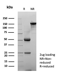 SDS-PAGE analysis of purified, BSA-free MICA antibody (MICA/4443) as confirmation of integrity and purity.