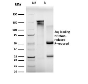 SDS-PAGE analysis of purified, BSA-free B-cell lymphoma/leukemia 11A antibody (clone PCRP-BCL11A-1H3) as confirmation of integrity and purity.