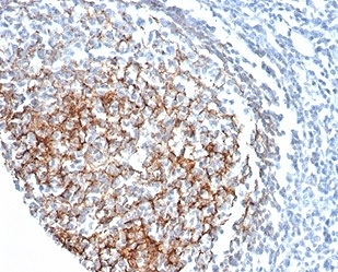 CD35 Antibody Tonsil IHC. Immunohistochemistry of CD35 / CR1 in FFPE human tonsil tissue using mouse monoclonal CD35 antibody, clone CR1/6378. HRP-DAB brown staining highlights a follicular dendritic cell network within germinal centers, showing a characteristic mesh-like pattern consistent with complement receptor localization, while surrounding lymphocytes show minimal staining and nuclei are counterstained blue. Heat induced epitope retrieval was performed by boiling tissue sections in pH 9 10 mM Tris with 1 mM EDTA for 20 min followed by cooling prior to staining.