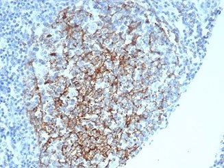 CD35 Antibody Spleen IHC. Immunohistochemistry of CD35 / CR1 in FFPE human spleen tissue using mouse monoclonal CD35 antibody, clone CR1/6378. HRP-DAB brown staining highlights a follicular dendritic cell network within splenic white pulp, showing a reticular mesh-like pattern consistent with complement receptor localization in germinal center-associated stromal cells, while surrounding lymphoid cells show minimal staining and nuclei are counterstained blue. Heat induced epitope retrieval was performed by boiling tissue sections in pH 9 10 mM Tris with 1 mM EDTA for 20 min followed by cooling prior to staining.