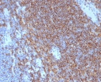 CD4 Antibody for IHC. Analysis of CD4 antibody staining in FFPE human lymph node tissue shows strong membranous labeling of CD4-positive T helper lymphocytes predominantly within paracortical regions, with relative sparing of B cell follicles, highlighting T cell interaction zones within lymphoid tissue. This Immunological Synapse Formation Antibody (clone CD4/7142) demonstrates selective detection of CD4-expressing lymphocytes involved in cell-cell contact and immune synapse organization. Heat-induced epitope retrieval was performed by boiling tissue sections in pH 9 10 mM Tris with 1 mM EDTA for 20 minutes followed by cooling before testing.