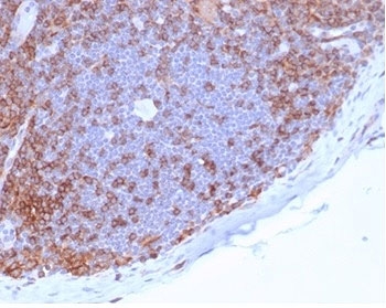 CD4 Antibody for IHC. Analysis of CD4 antibody staining in FFPE human lymph node tissue shows strong membranous labeling of CD4-positive T helper lymphocytes predominantly within paracortical regions, with relative sparing of B cell follicles, highlighting adaptive immune cell distribution within lymphoid tissue. This Adaptive Immunity Marker Antibody (clone CD4/7144) demonstrates selective detection of T helper cell populations involved in coordinating adaptive immune responses. Heat-induced epitope retrieval was performed by boiling tissue sections in pH 9 10 mM Tris with 1 mM EDTA for 20 minutes followed by cooling before testing.