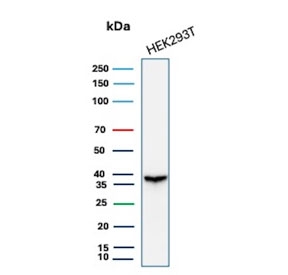 Recombinant Aldose reductase 1B1 Antibody WB. Western blot testing of human 293T cell lysate with recombinant Aldose reductase 1B1 antibody (clone rAKR1B1/7296). Predicted molecular weight ~36 kDa.
