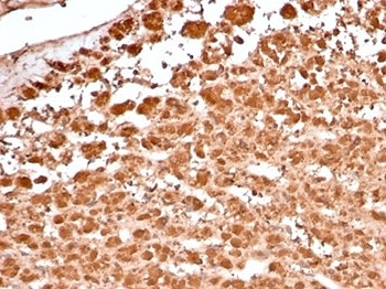 Recombinant Aldose reductase 1B1 Antibody Adrenal Gland IHC. Immunohistochemistry staining of FFPE human adrenal gland tissue with recombinant Aldose reductase 1B1 antibody (clone rAKR1B1/7296). HIER: boil tissue sections in pH 9 10mM Tris with 1mM EDTA for 20 min and allow to cool before testing.