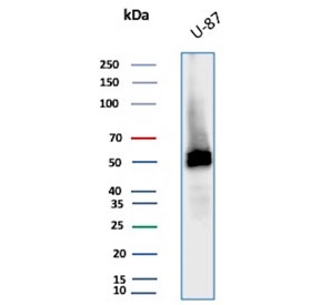 Vimentin Antibody / Cellular Plasticity Marker Antibody WB. Western blot analysis of human U-87 MG cell lysate using Vimentin antibody detects a prominent band at approximately 55 kDa, consistent with the predicted molecular weight of Vimentin (VIM). The rabbit monoclonal clone VIM/6576R shows a clear band, supporting detection of intermediate filament components associated with adaptable cellular states. The presence of Vimentin in U-87 MG cells aligns with its role in cytoskeletal organization linked to phenotypic flexibility and cellular plasticity.