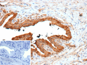 Galectin 3 Antibody by IHC in human prostate. Immunohistochemistry of FFPE human prostate tissue using Galectin 3 Antibody LGALS3/13233R. Brown immunoreactivity is prominent in glandular epithelial cells, with staining distributed predominantly in the cytoplasm. The inset shows a negative control in which PBS replaced the primary antibody.