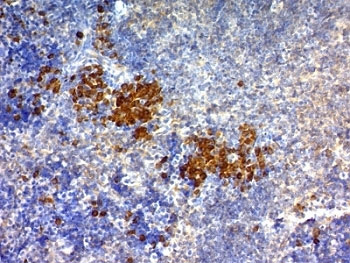 <p>IHC: Formalin-fixed, paraffin-embedded mouse spleen stained with anti-CD63 antibody (<a href="../tds/anti-cd63-antibody-lamp-3-spm524-v9106" target="_blank" rel="noopener">clone SPM524, cat # V9061</a>) and DAB chromogen</p>