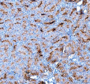 <p>IHC staining of FFPE rat kidney tissue with Aquaporin 1 antibody (<a href="../tds/aqp1-antibody-aquaporin-1-r30178" target="_blank" rel="noopener">cat # R30178</a>). HIER: boil tissue sections in pH8 EDTA for 20 min and allow to cool before testing.</p>