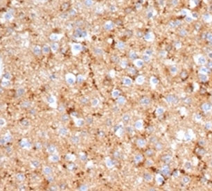<p>IHC staining of FFPE human brain tissue with recombinant <a href="../tds/recombinant-syp-antibody-synaptophysin-rsyp6856-v9154" target="_blank" rel="noopener">Synaptophysin / SYP antibody</a> (clone rSYP/6856).</p>