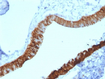 <p>IHC staining of FFPE human ovary tissue with <a href="../tds/cytokeratin-3-antibody-krt3-krt32130-v7909" target="_blank" rel="noopener">KRT3 antibody</a> (clone KRT3/2130).</p>