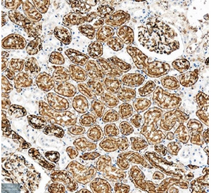 <p>IHC staining of FFPE human kidney tissue with Aquaporin 1 / AQP1 antibody (<a href="../tds/aquaporin-1-antibody-aqp1-r32050" target="_blank" rel="noopener">Cat # R32050</a>). HIER: boil tissue sections in pH8 EDTA for 20 min and allow to cool before testing.</p>