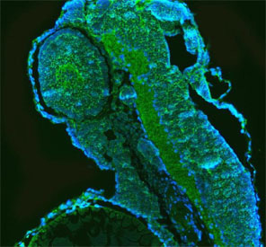 <p><strong data-start="123" data-end="282">Zebrafish Gnb1 Antibody Embryo Immunofluorescence (IF). Immunofluorescence analysis of Gnb1 expression in Danio rerio embryo tissue using zebrafish <a href="../tds/zebrafish-gnb1-antibody-rz1045" target="_blank" rel="noopener">Gnb1 antibody</a>.</strong> FFPE zebrafish embryo sections show cytoplasmic and membrane-associated fluorescence signal (green) within developing embryonic structures, consistent with the role of guanine nucleotide-binding protein subunit beta 1 in signal transduction pathways. DAPI nuclear counterstain (blue) highlights overall tissue architecture. This image demonstrates the use of zebrafish antibodies for protein localization, signaling pathway analysis, and developmental biology studies in the zebrafish model.</p>