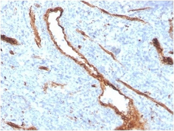 <p><strong data-start="0" data-end="63" data-is-only-node="">von Willebrand Factor Antibody Bone Marrow Vasculature IHC.</strong> Immunohistochemistry analysis of human bone marrow tissue using von Willebrand Factor Antibody clone <a href="../tds/recombinant-von-willebrand-factor-antibody-vwf-vwf4384r-v9636">VWF/4384R</a> demonstrates strong HRP-DAB brown staining of endothelial cells lining sinusoidal vascular channels throughout the marrow microenvironment. The staining pattern highlights an extensive network of branching blood vessels and sinusoidal structures, consistent with the established endothelial localization of von Willebrand factor (VWF), a key mediator of platelet adhesion, vascular integrity, and hemostatic regulation. This image illustrates the close relationship between vascular endothelium and platelet biology within hematopoietic tissue. HIER: boil tissue sections in pH 9 10mM Tris with 1mM EDTA for 20 min and allow to cool before testing.</p>