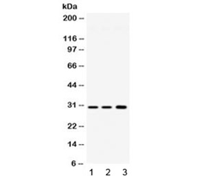 <p>Western blot testing of 1) rat brain, 2) mouse brain and 3) human HeLa lysate with AQP11 antibody (<a href="../tds/aqp11-antibody-aquaporin-11-r32512" target="_blank" rel="noopener">cat # R32512</a>) at 0.5ug/ml. Predicted molecular weight 26~30 kDa.</p>