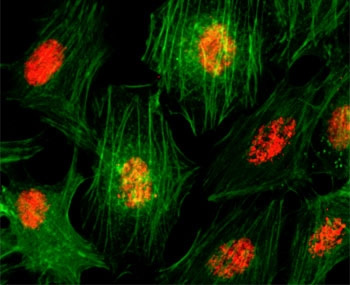 <p><strong data-start="3881" data-end="3907">Histone H3 Antibodies.</strong> Immunofluorescence analysis of Histone H3 in human cells using a Histone H3 antibody shows strong nuclear staining consistent with chromatin-associated localization. Nuclear signal reflects distribution of Histone H3 within nucleosomes, supporting its role in chromatin organization and epigenetic regulation, while cytoplasmic structures provide morphological context.</p>