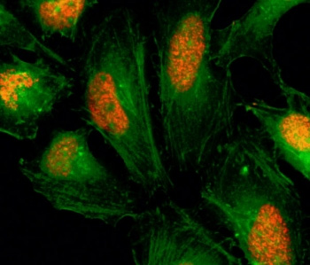 <p><strong data-start="3305" data-end="3332">Histone H2A Antibodies.</strong> Immunofluorescence analysis of the Histone H2A variant H2A.Z (H2AFZ) in human HeLa cells using a Histone H2A.Z antibody shows strong nuclear staining (red), consistent with chromatin-associated localization at regulatory regions and transcriptionally active chromatin. Actin filaments (green) highlight cell morphology and reinforce nuclear enrichment of Histone H2A within chromatin.</p>