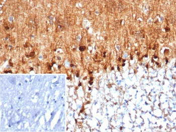 <p><strong data-start="0" data-end="35" data-is-only-node="">S100B Antibody Human Brain IHC.</strong> Immunohistochemistry analysis of FFPE human brain tissue using S100B Antibody <a href="../tds/s100b-antibody-s100b4159-v4848">clone S100B/4159</a> demonstrates strong HRP-DAB brown nuclear and cytoplasmic staining within astrocyte-like glial cells distributed throughout the neural parenchyma. The staining pattern is consistent with the established expression of S100 calcium-binding protein B (S100B), a glial-associated protein involved in calcium signaling, astrocyte function, and nervous system homeostasis. Prominent staining of cells with characteristic astroglial morphology highlights the utility of S100B as a marker of astrocyte biology and neurobiological research. The inset image represents a secondary antibody negative control in which PBS was used in place of the primary antibody and shows absence of specific staining.</p>