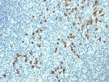<p>IHC staining of FFPE human tonsil tissue with <a href="../tds/lambda-light-chain-antibody-hp6054-v3151" target="_blank" rel="noopener">Lambda Light Chain antibody</a> (clone HP6054).</p>