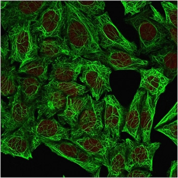 <p>Immunofluorescent staining of methanol-fixed human HeLa cells with <a href="../tds/cytokeratin-7-antibody-ov-tl1230-v2654" target="_blank" rel="noopener">KRT7 antibody</a> (clone OV-TL12/30).</p>