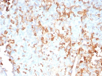 <p>IHC staining of FFPE human adrenal gland tissue with IL-2 antibody (<a href="../tds/il-2-antibody-interleukin-2-il29007-v5371" target="_blank" rel="noopener">clone IL2/9007, cat # V5371</a>). HIER: boil tissue sections in pH 9 10mM Tris with 1mM EDTA for 20 min and allow to cool before testing.</p>