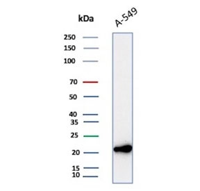 <p>Western blot testing of human A549 cell lysate with <a href="../tds/bax-antibody-2d2-v2005" target="_blank" rel="noopener">Bax antibody</a> (clone 2D2). Predicted molecular weight ~21 kDa.</p>