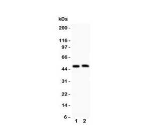 <p>Western blot testing of Aquaporin 0 antibody (<a href="../tds/aquaporin-0-antibody-r31222" target="_blank" rel="noopener">cat # R31222</a>) and Lane 1: mouse spleen; 2: mouse intestine; Observed molecular weight: 28-69 kDa depending on level of glycosylation.</p>