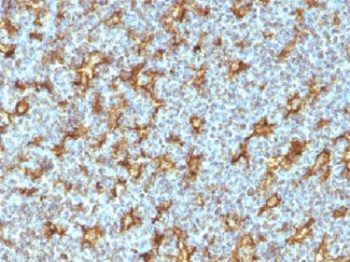 <p>IHC testing of human tonsil with <a href="../tds/cd11c-antibody-itgax1242-v2643" target="_blank" rel="noopener">CD11c antibody</a> (clone ITGAX/1242).&nbsp;<em>Note specific staining of dendritic cells.</em> Required HIER: boil tissue sections in 10mM Tris with 1mM EDTA, pH 9, for 10-20 min.</p>