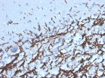 <p>IHC staining of FFPE human brain with recombinant <a href="../tds/recombinant-myelin-basic-protein-antibody-mbp4277r-v8436" target="_blank" rel="noopener">Myelin Basic Protein antibody</a> (clone MBP/4277R).</p>