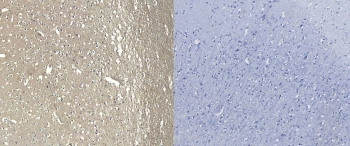 <p>IHC staining of FFPE human frontal cortex tissue with <a href="../tds/aif-1-antibody-iba1-r36179">AIF-1 antibody</a> (left) and without AIF-1 antibody (right, negative control).</p>