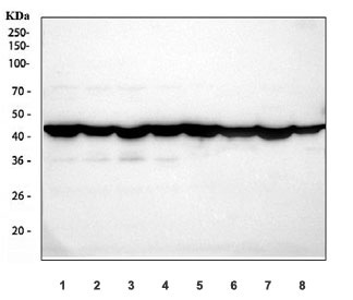 <p>Western blot testing of 1) human HeLa, 2) human K562, 3) human MCF7, 4) human Jukrat, 5) rat brain, 6) rat kidney, 7) mouse brain and 8) mouse kidney tissue lysate with Beta Actin antibody (<a href="../tds/b-actin-antibody-beta-actin-antibody-r30971" target="_blank" rel="noopener">cat # R30971</a>). Predicted molecular weight ~48 kDa.</p>