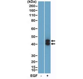<p>Phospho-ERK1/2 Antibody WB. Western blot analysis of human A431 cell lysates untreated (-) or stimulated (+) with epidermal growth factor (EGF) using a <a href="../tds/phospho-erk12-antibody-pthr202ptyr204-rm451-r20465" target="_blank" rel="noopener">phospho-ERK1/2 antibody</a> detecting ERK1 and ERK2 phosphorylated at Thr202 and Tyr204. Two bands are observed at approximately 42 kDa and 43 kDa, corresponding to ERK1 and ERK2, with increased signal following EGF treatment, demonstrating activation of MAPK signaling.</p>