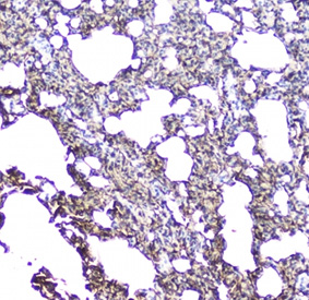 <p>IHC staining of FFPE rat lung with Aquaporin 5 antibody (<a href="../tds/aqp5-antibody-aquaporin-5-rq4537" target="_blank" rel="noopener">cat # RQ4537</a>) at 1ug/ml. HIER: boil tissue sections in pH6, 10mM citrate buffer, for 10-20 min followed by cooling at RT for 20 min.</p>