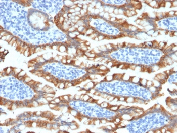 <p>IHC testing of FFPE human small intestine tissue with recombinant Cytokeratin 8 antibody (<a href="../tds/recombinant-cytokeratin-8-antibody-rabbit-monoclonal-krt82174r-v3562" target="_blank" rel="noopener">clone KRT8/2174R, cat # V3562</a>).</p>