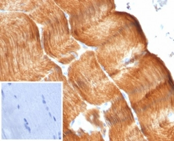 <p><strong data-start="0" data-end="58" data-is-only-node="">Sarcomeric Alpha Actinin Antibody Skeletal Muscle IHC.</strong> Immunohistochemistry analysis of FFPE human skeletal muscle tissue using recombinant Sarcomeric Alpha Actinin Antibody clone ACTN2/7041R demonstrates strong HRP-DAB brown staining throughout striated muscle fibers. The staining pattern highlights the organized contractile architecture of skeletal muscle and is consistent with the established localization of Alpha Actinin 2 (ACTN2), a major Z-disc-associated protein that cross-links actin filaments and supports sarcomere organization. This image illustrates the highly ordered structure of the muscle contractile apparatus and supports studies of muscle biology, sarcomere assembly, and cardiovascular research. The inset image represents a negative control in which PBS was used in place of the primary antibody and shows absence of specific staining. HIER: boil tissue sections in pH 9 10mM Tris with 1mM EDTA for 20 min and allow to cool before testing.</p>