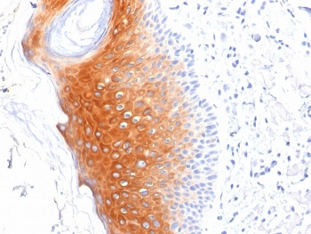 <p>IHC staining of FFPE human skin tissue with <a href="../tds/cytokeratin-1-antibody-ck1-keratin-1-lhk1-v7907" target="_blank" rel="noopener">KRT1 antibody</a> (clone LHK1).</p>