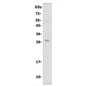 <p>Western blot testing of AQP8 antibody (<a href="../tds/aquaporin-8-antibody-r30584" target="_blank" rel="noopener">cat # R30584</a>) and human PC-3 cell lysate. The predicted ~27 kDa protein may be visualized at higher molecular weights due to glycosylation.</p>