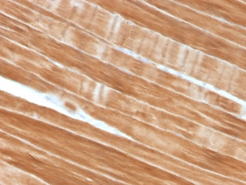 <p><strong data-start="0" data-end="64" data-is-only-node="">Sarcomeric Alpha Actinin Antibody Skeletal Muscle Fiber IHC.</strong> Immunohistochemistry analysis of FFPE human skeletal muscle tissue using Sarcomeric Alpha Actinin Antibody <a href="../tds/sarcomeric-alpha-actinin-antibody-actn2-actn23292-v7529">clone ACTN2/3292</a> demonstrates strong HRP-DAB brown staining throughout elongated striated muscle fibers. The staining pattern highlights the highly organized contractile architecture of skeletal muscle and is consistent with the established localization of Alpha Actinin 2 (ACTN2), a key Z-disc protein responsible for actin filament anchoring and sarcomere organization. This image illustrates the orderly arrangement of the skeletal muscle contractile apparatus and supports studies of muscle differentiation, sarcomere assembly, and striated muscle biology. HIER: boil tissue sections in pH6, 10mM citrate buffer, for 10-20 min and allow to cool before testing.</p>