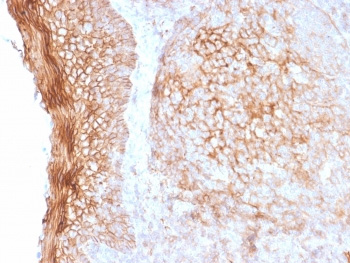 <p>IHC staining of FFPE human tonsil tissue with <a href="../tds/cd73-antibody-nt5e2505-v7571" target="_blank" rel="noopener">CD73 antibody</a> (clone NT5E/2505).</p>