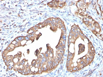 <p>IHC staining of FFPE human small intestine tissue with AQP4 antibody (<a href="../tds/aqp4-antibody-aquaporin-4-aqp43323-v5750" target="_blank" rel="noopener">clone AQP4/3323, cat # V5750</a>). HIER: boil tissue sections in pH 9 10mM Tris with 1mM EDTA for 20 min and allow to cool before testing.</p>