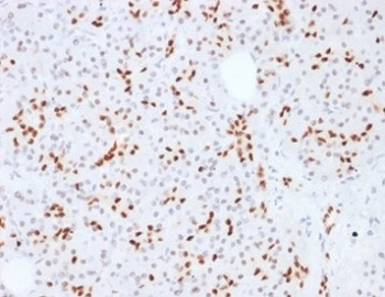 <p><strong data-start="0" data-end="37" data-is-only-node="">SOX9 Antibody Human Pancreas IHC.</strong> Immunohistochemistry analysis of FFPE human pancreas tissue using SOX9 Antibody clone SOX9/2387 demonstrates strong HRP-DAB brown nuclear staining within pancreatic ductal epithelial cells and scattered SOX9-positive progenitor-associated cell populations. The staining pattern is consistent with the established role of SRY-box transcription factor 9 (SOX9) as a key regulator of cellular differentiation, developmental lineage specification, and stem cell maintenance. This image highlights nuclear SOX9 expression in pancreatic epithelial compartments and supports studies of stem cell biology, developmental regulation, tissue regeneration, and progenitor cell function. HIER: heat-induced epitope retrieval performed using pH 9 Tris-EDTA buffer.</p>