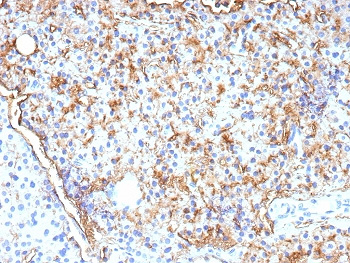 <p>IHC staining of FFPE human parathyroid tissue with CD109 antibody (<a href="../tds/cd109-antibody-cd1099955-v5675" target="_blank" rel="noopener">clone CD109/9955, clone V5675</a>). HIER: boil tissue sections in pH 9 10mM Tris with 1mM EDTA for 20 min and allow to cool before testing.</p>