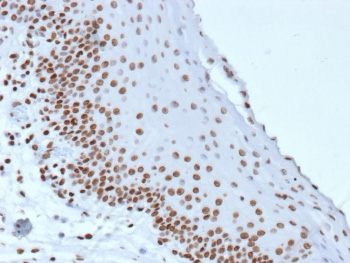 <p><strong data-start="4344" data-end="4367">Histone Antibodies.</strong> Immunohistochemistry analysis of histone proteins in human cells using histone antibodies demonstrates strong nuclear staining consistent with chromatin-associated localization. Nuclear signal reflects distribution of histones within nucleosomes, supporting their role in chromatin organization, epigenetic regulation, and genome stability, while cytoplasmic structures provide morphological context.</p>